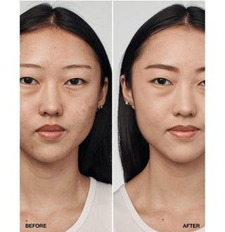 Even Better Clinical Serum Foundation SPF 20 30ml