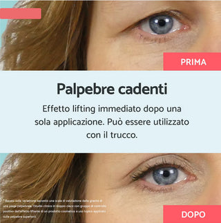 DROPPING EYELIDS 8ml