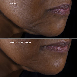 Clinique Smart Clinical Repair™ Lifting Face + Neck Cream