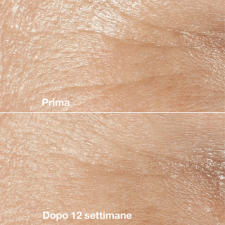 Clinique Smart Clinical Repair™ Wrinkle Correcting Rich Cream