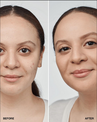 Even Better Clinical Serum Foundation SPF 20 30ml